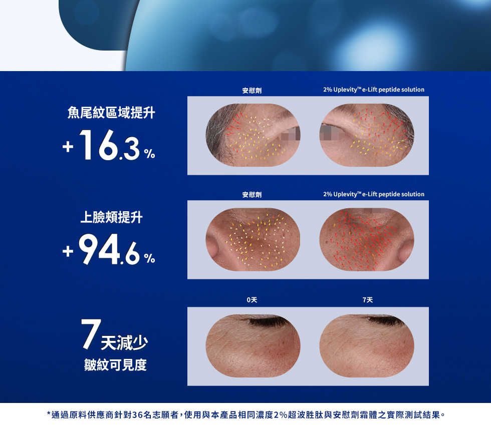 薇佳｜超波肽外泌體藻針精華乳