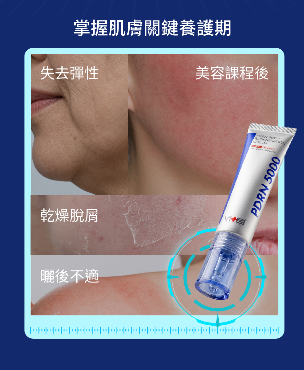 水光級PDRN
