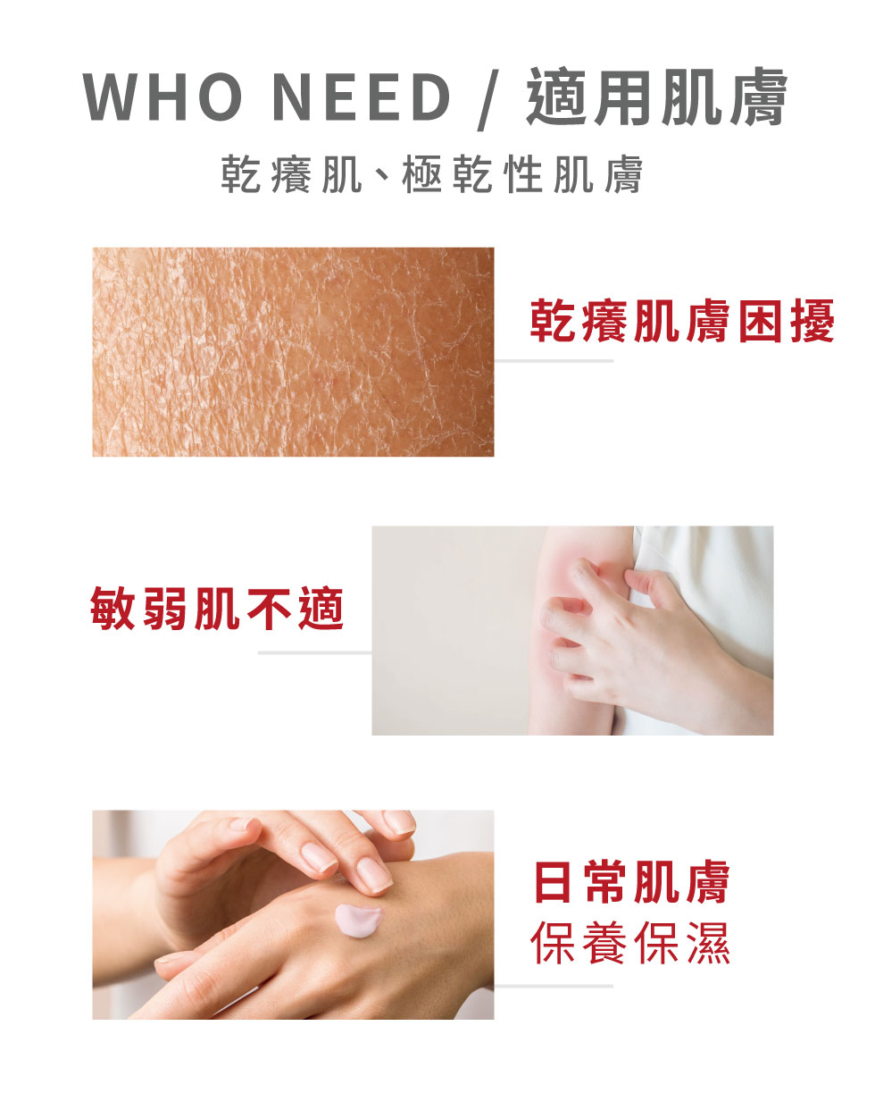 薇佳 拒乾修復乳液 適用肌膚有這些