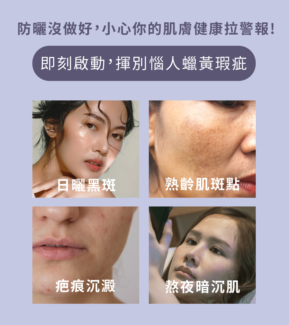 揮別老人蠟黃瑕疵